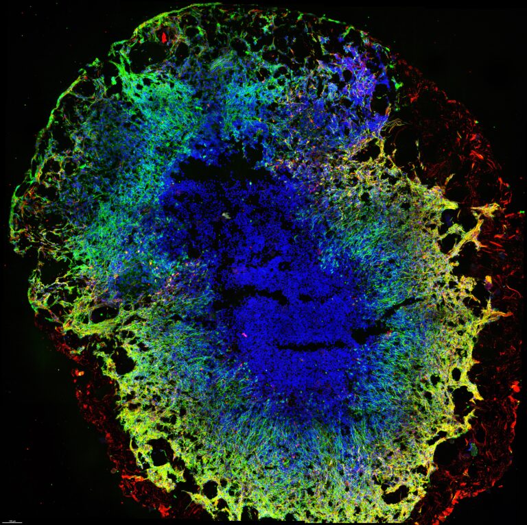 Midbrain Organoid Lambda Biologics